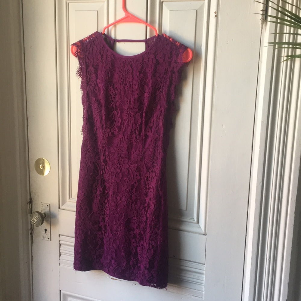 Urban Outfitters Lace Dress with Deep V Back